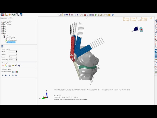 فیلم آموزشی: شبیه سازی زانو SIMULIA Abaqus