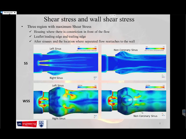 فیلم آموزشی: راه اندازی ANSYS CFX برای جریان ضربانی برای دریچه قلب مکانیکی سنت جود - قسمت 2 با زیرنویس فارسی