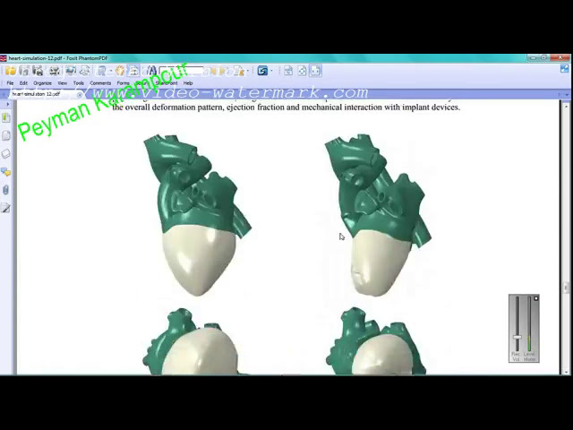 فیلم آموزشی: شبیه سازی قلب انسان در آباکوس CFD