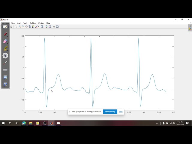 فیلم آموزشی: پردازش سیگنال ECG اولیه با استفاده از MATLAB با زیرنویس فارسی